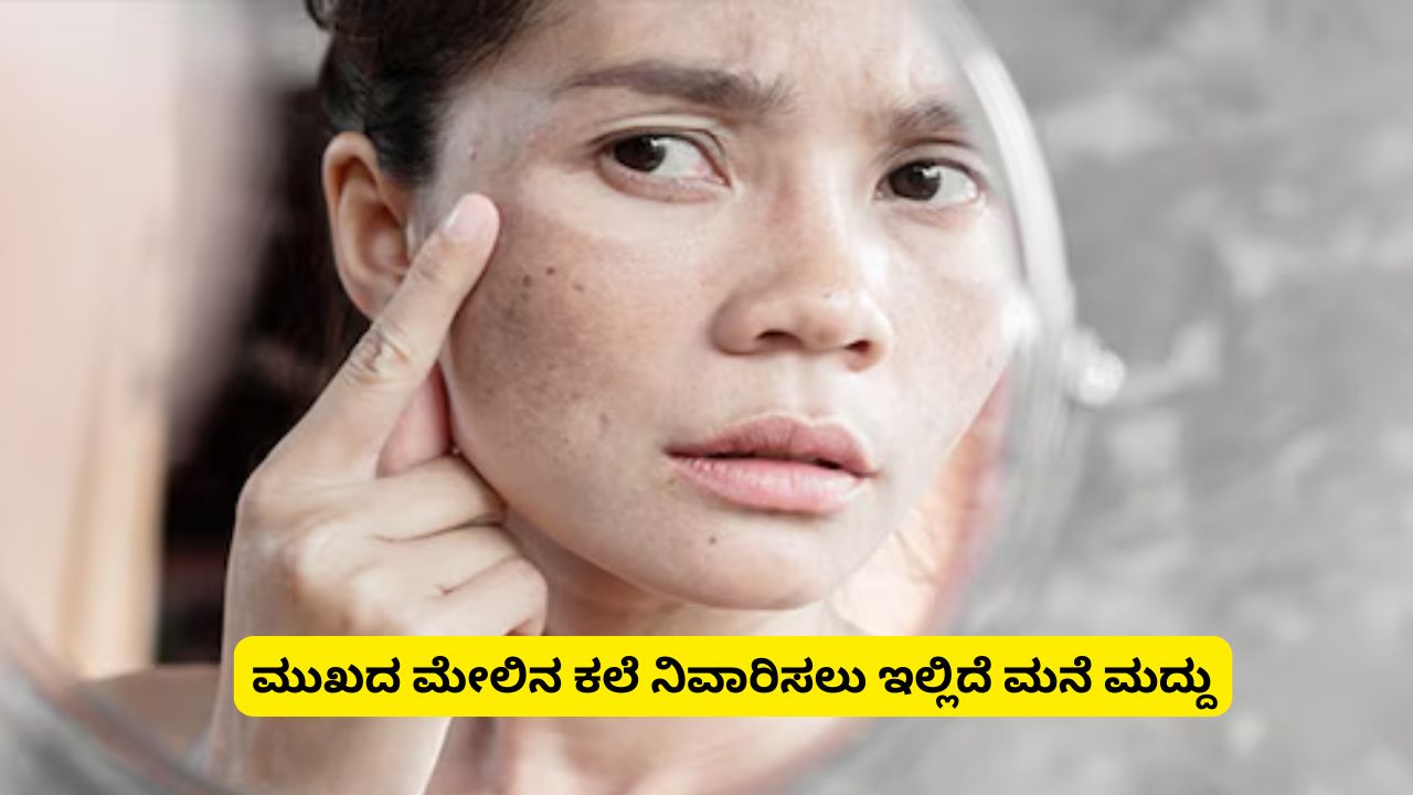 Home Remedies to Remove Dark Spots and Get Soft, Glowing Skin Naturally