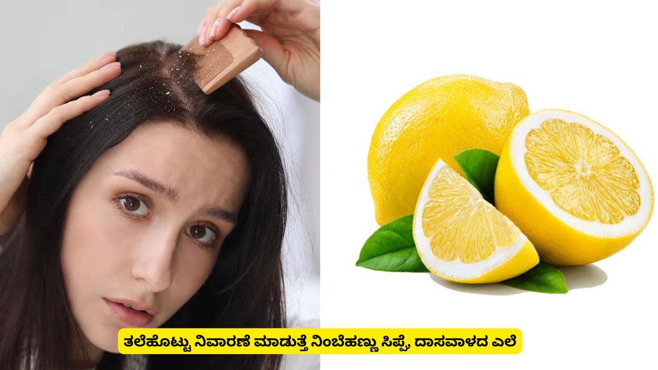 Ayurvedic health tips: Lemon peel and hibiscus leaves can help get rid of dandruff